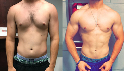 Gyno | Chiseled Abs
