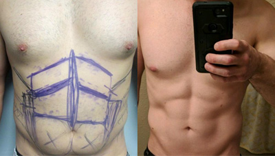 Chiseled Abs Picture 7