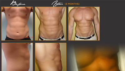 Chiseled Abs Picture 8