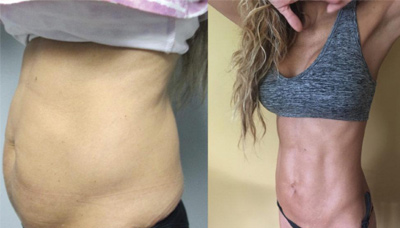 Chiseled Abs Picture 9