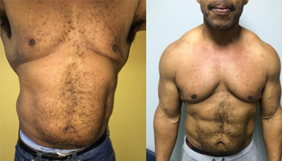 Chiseled Abs Picture 10