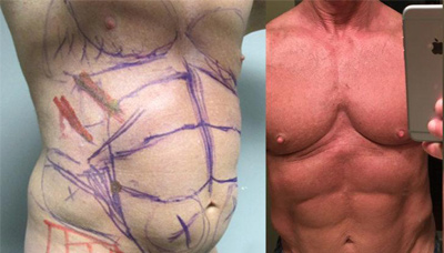 Chiseled Abs Picture 13