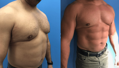 Chiseled Abs Picture 4