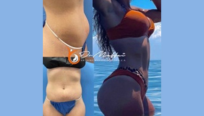 Flatter Stomach Picture 12