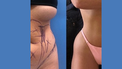 Flatter Stomach Picture 15