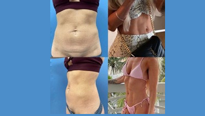 Flatter Stomach Picture 16