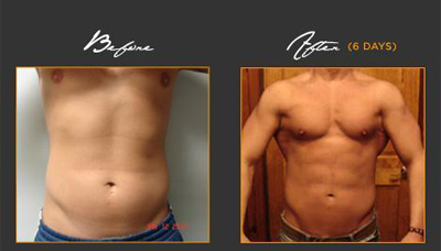 Chiseled Abs Picture 15