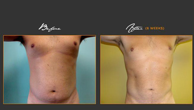 Chiseled Abs Picture 17