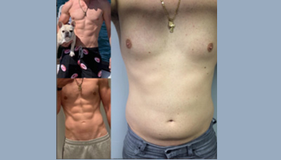Chiseled Abs Picture 18
