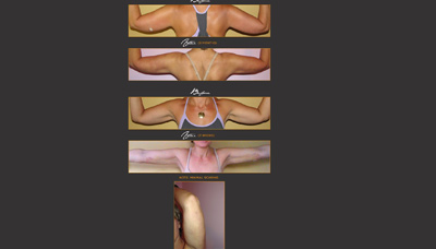 Slimmer Arms Picture 4