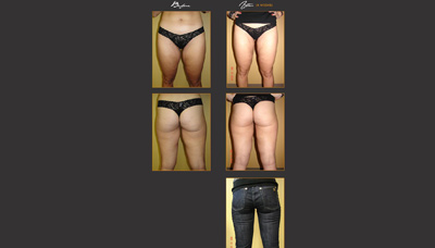 Thinner Thighs Picture 3