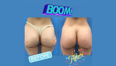 Thinner Thighs Picture 5