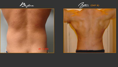 Toner Love Handles Picture 1