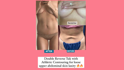 Double Reverse Tuck Picture 1